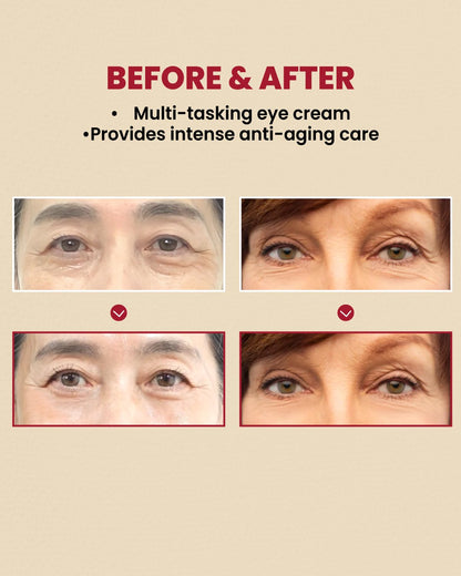 K-SECRET SEOUL 1988 Eye Cream : Retinal Liposome 4% + Fermented Bean 30ml