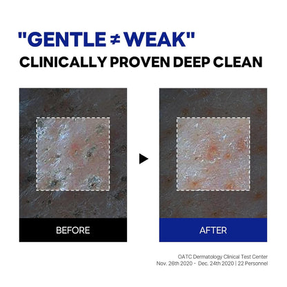 ROUND LAB Birch Juice Moisturizing Cleanser 150ml (water gel type)