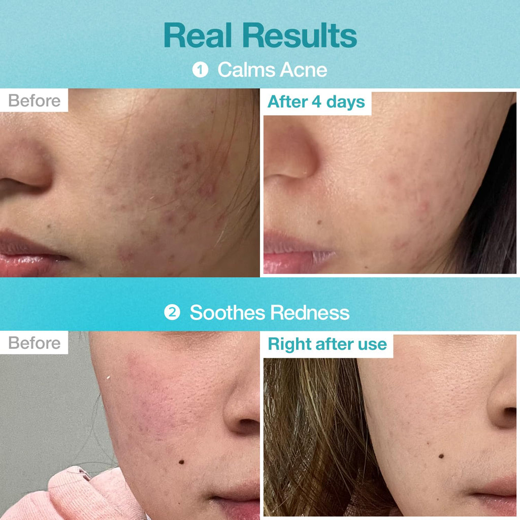 numbuzin No.1 Pantothenic B5 Hyaluronic Active Clear Mask 26ml X 10ea