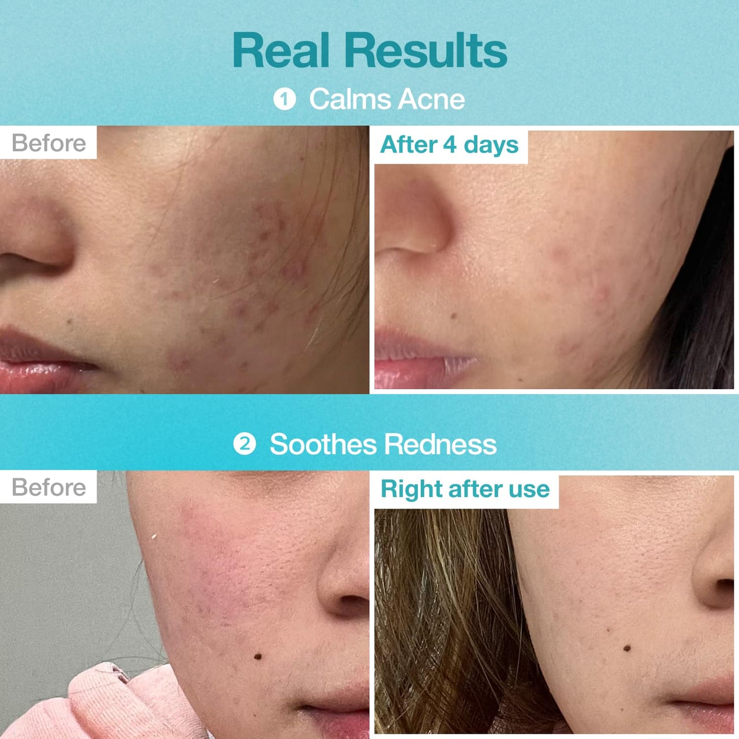 numbuzin No.1 Pantothenic B5 Hyaluronic Active Clear Mask 26ml X 10ea