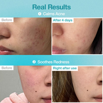 numbuzin No.1 Pantothenic B5 Hyaluronic Active Clear Mask 26ml X 10ea