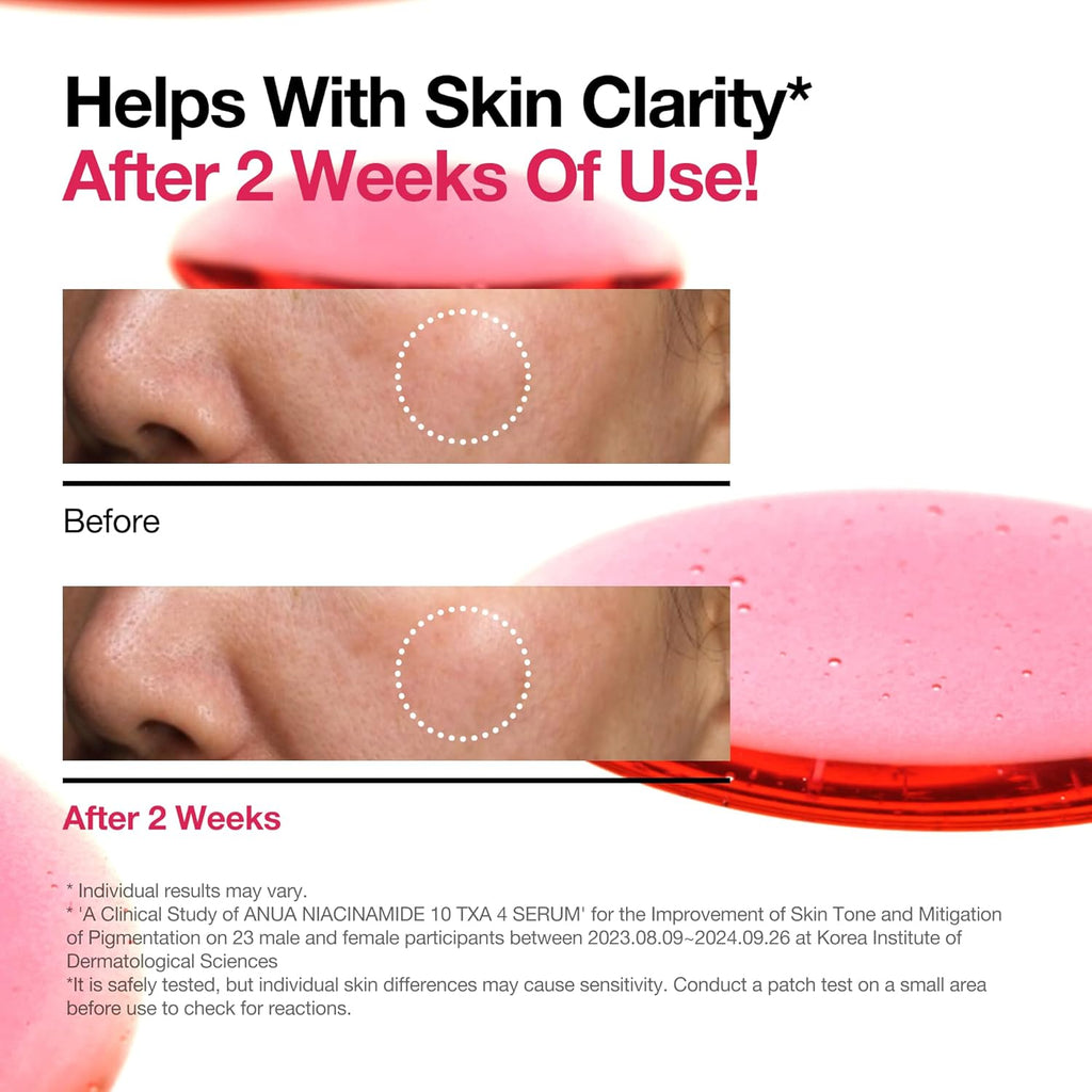 Anua Niacinamide 10% + TXA 4% Dark Spot Correcting Serum 30ml