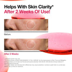 Anua Niacinamide 10% + TXA 4% Dark Spot Correcting Serum 30ml