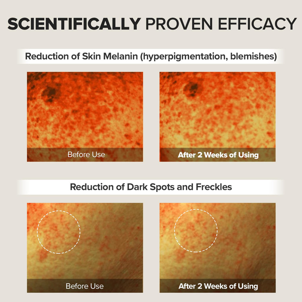 [MARY & MAY] Tranexamic Acid+Glutathion Eye Cream 30g