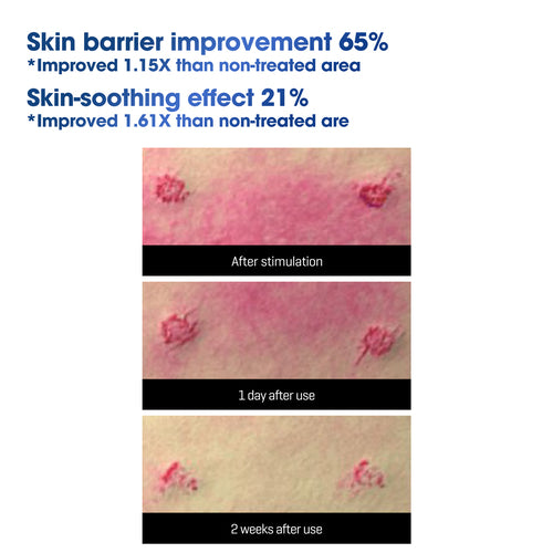 [SOME BY MI] Beta Panthenol Repair Serum 30ml