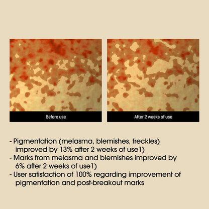 [SOME BY MI] Yuja Niacin Anti Blemish Serum 50ml