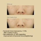 [SOME BY MI] Yuja Niacin Anti Blemish Serum 50ml