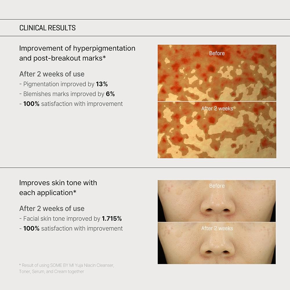 [SOME BY MI] Yuja Niacin Anti Blemish Cream 60g