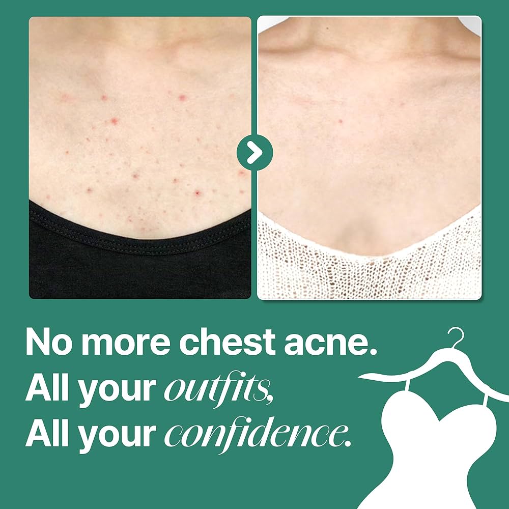 [SOME BY MI] AHA-BHA-PHA 30 Days Miracle Acne Body Cleanser 400g