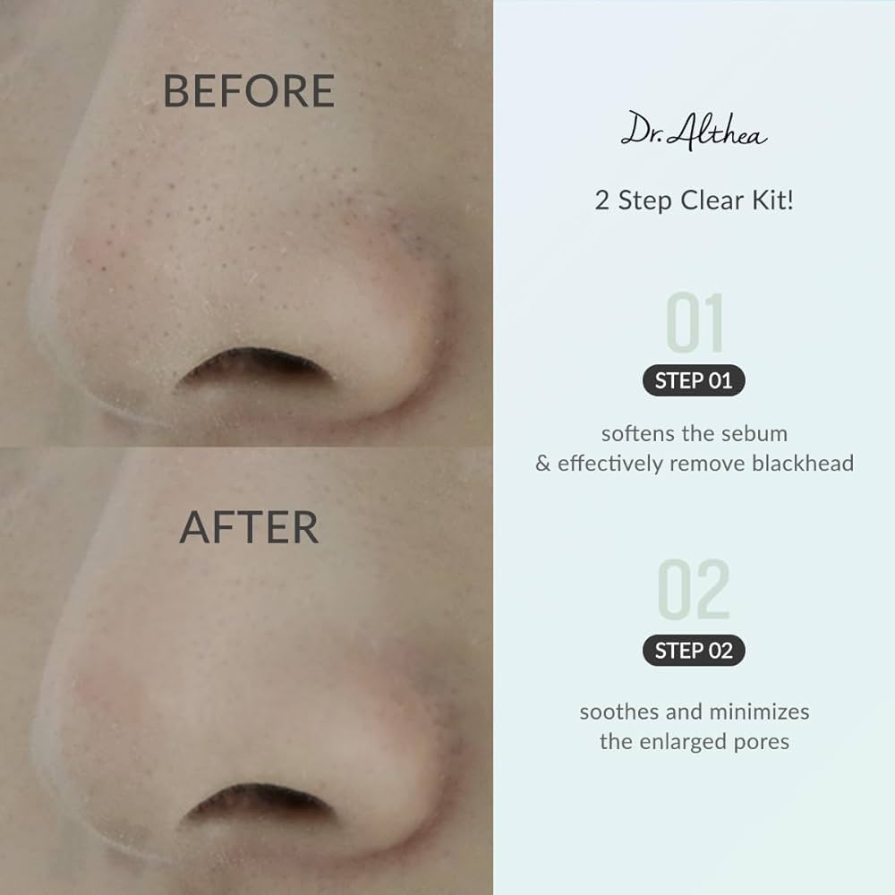 Dr.Althea Blackhead Zero 2 Step Nose Patch (1 STEP: 3g 4ea, 2 STEP: 3g 4ea)