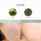 Dr.Althea Last Minute Skin Rescue Anastatica Mask 30ea/310ml