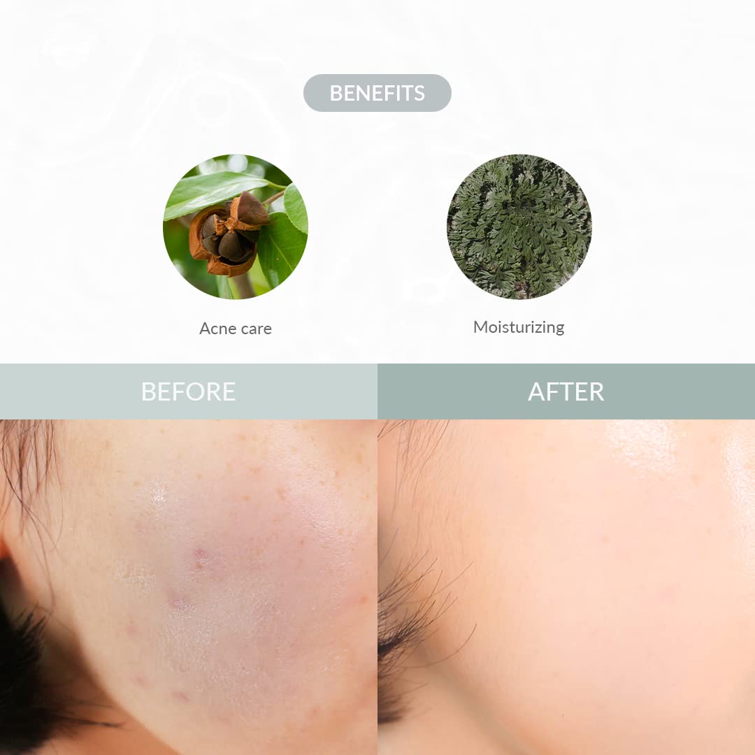 Dr.Althea Last Minute Skin Rescue Anastatica Mask 30ea/310ml