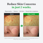 Dr.Althea Gentle Vitamin C Serum 30ml